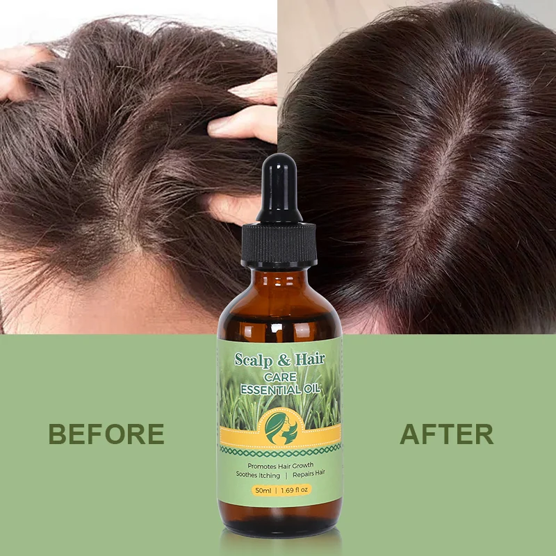 Hair Oil — view 6