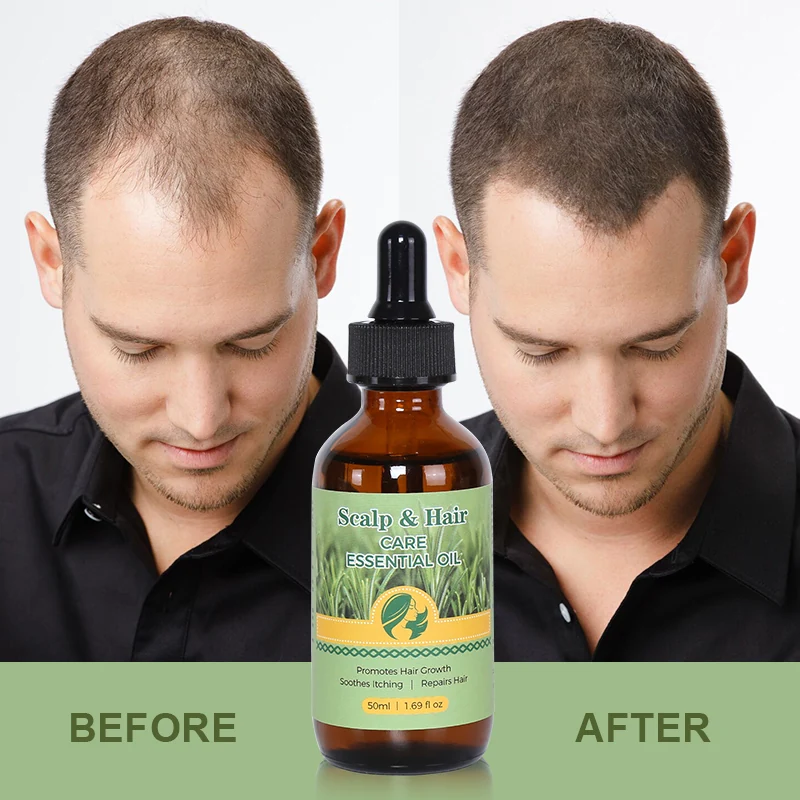 Hair Oil — view 7